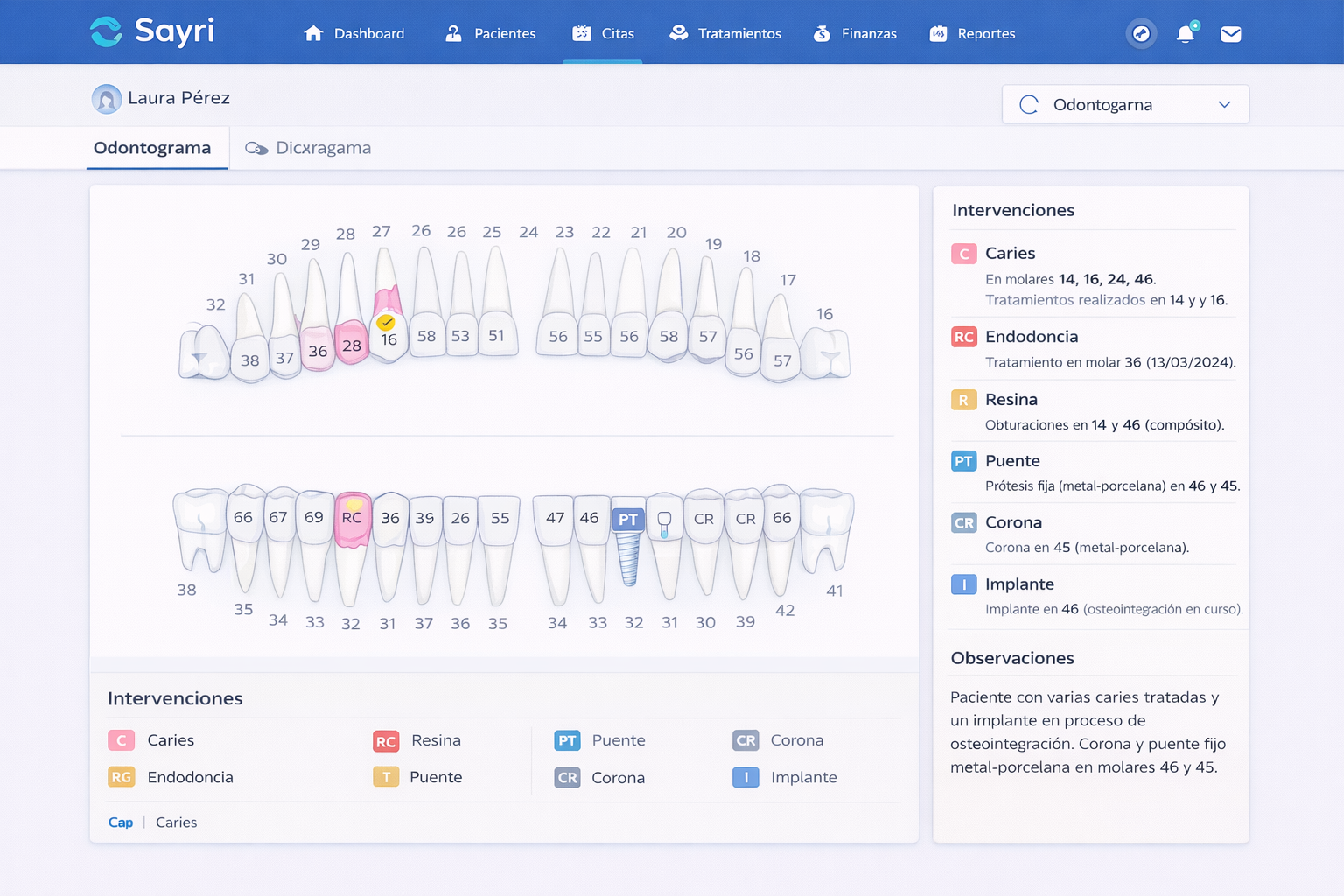 Odontograma digital de Sayri con piezas dentales y procedimientos registrados